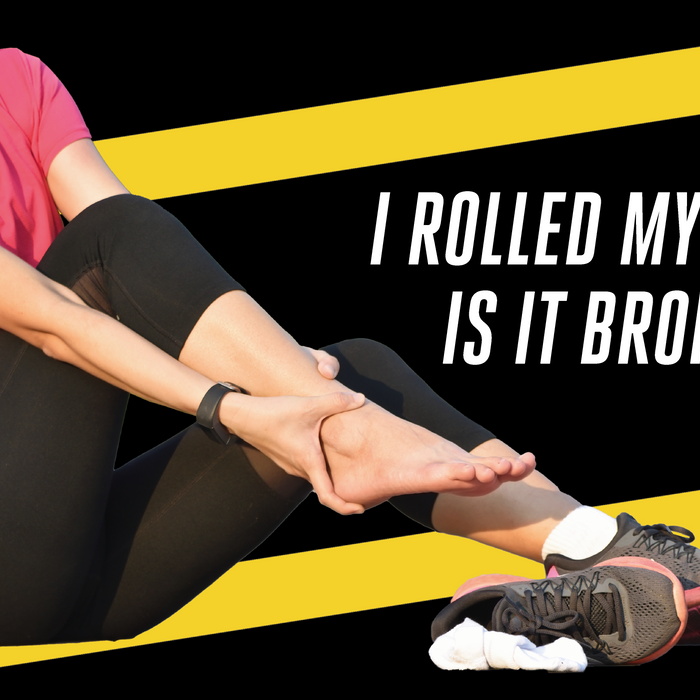 I Rolled my Ankle, is it broken?